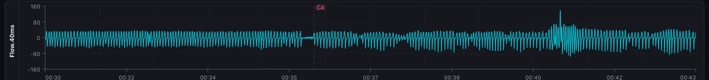 Flow rate over thirteen minutes: regular breaths, a flat stretch marked CA where breathing stopped, then breathing resuming