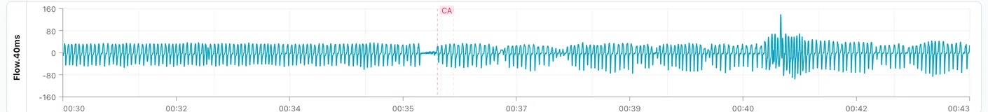 Flow rate over thirteen minutes: regular breaths, a flat stretch marked CA where breathing stopped, then breathing resuming
