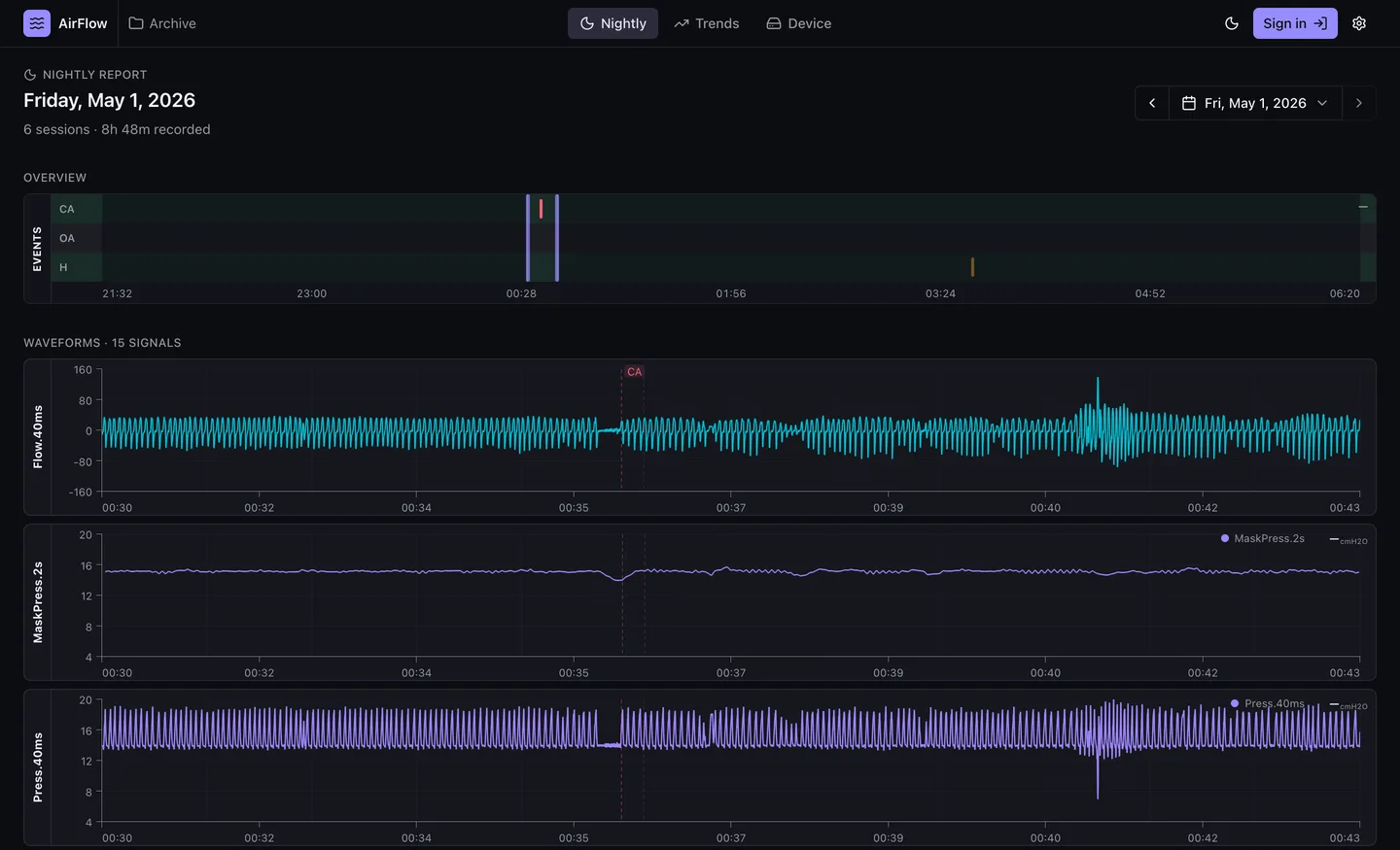 CPAPView nightly report of a real night: flow rate zoomed to a clear-airway event, with mask pressure and pressure waveforms