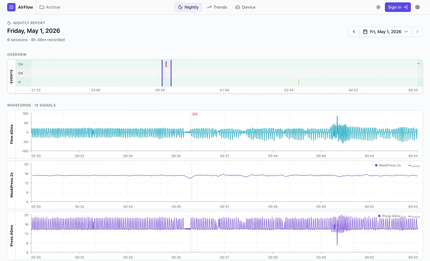 CPAPView nightly report of a real night: flow rate zoomed to a clear-airway event, with mask pressure and pressure waveforms